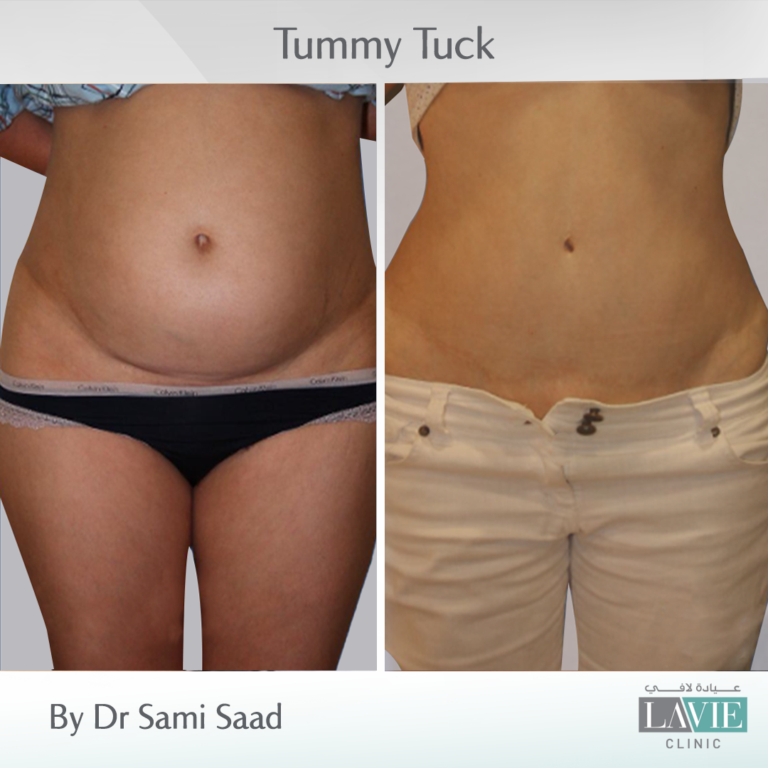 dr-sami-saad-cases-2