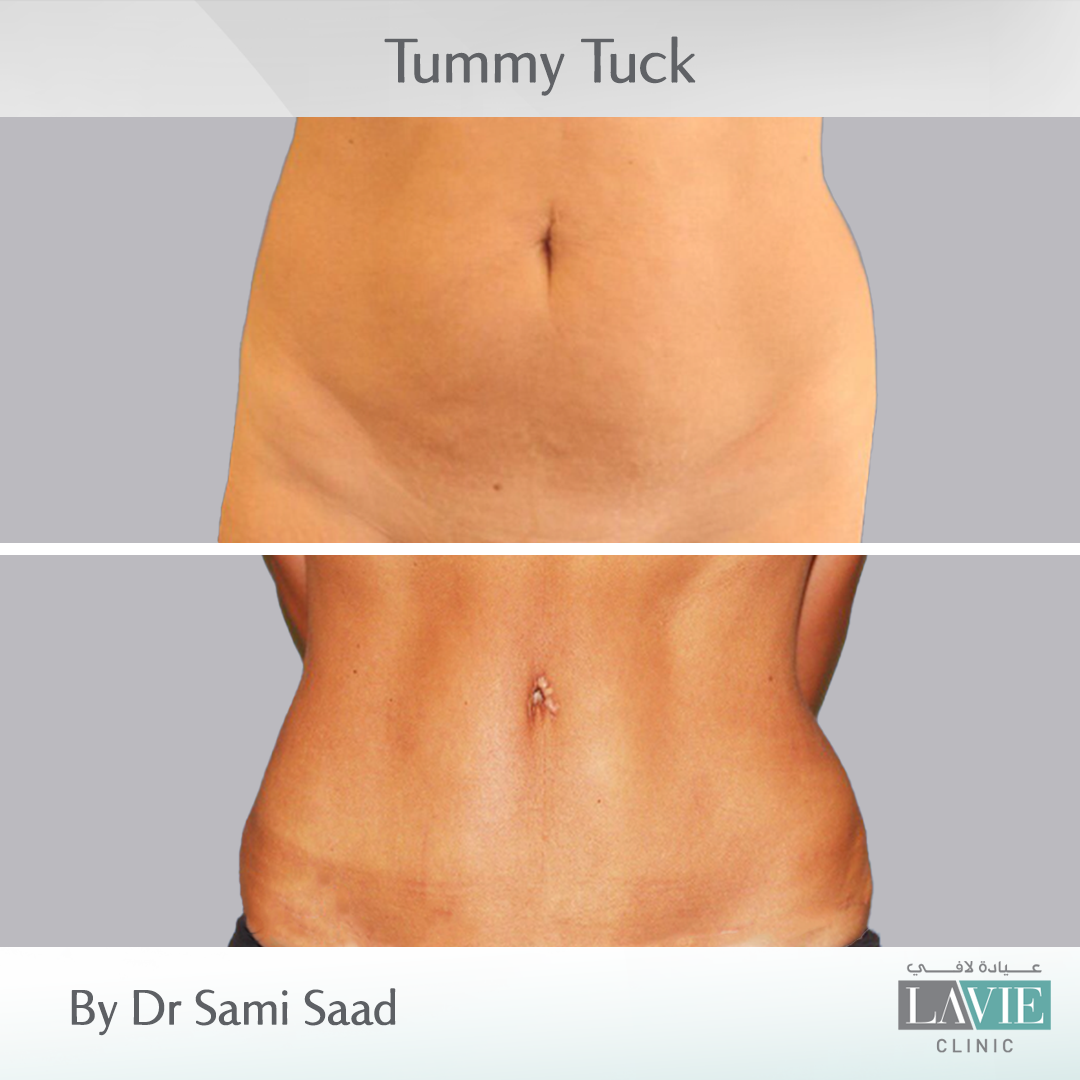 dr-sami-saad-cases-3