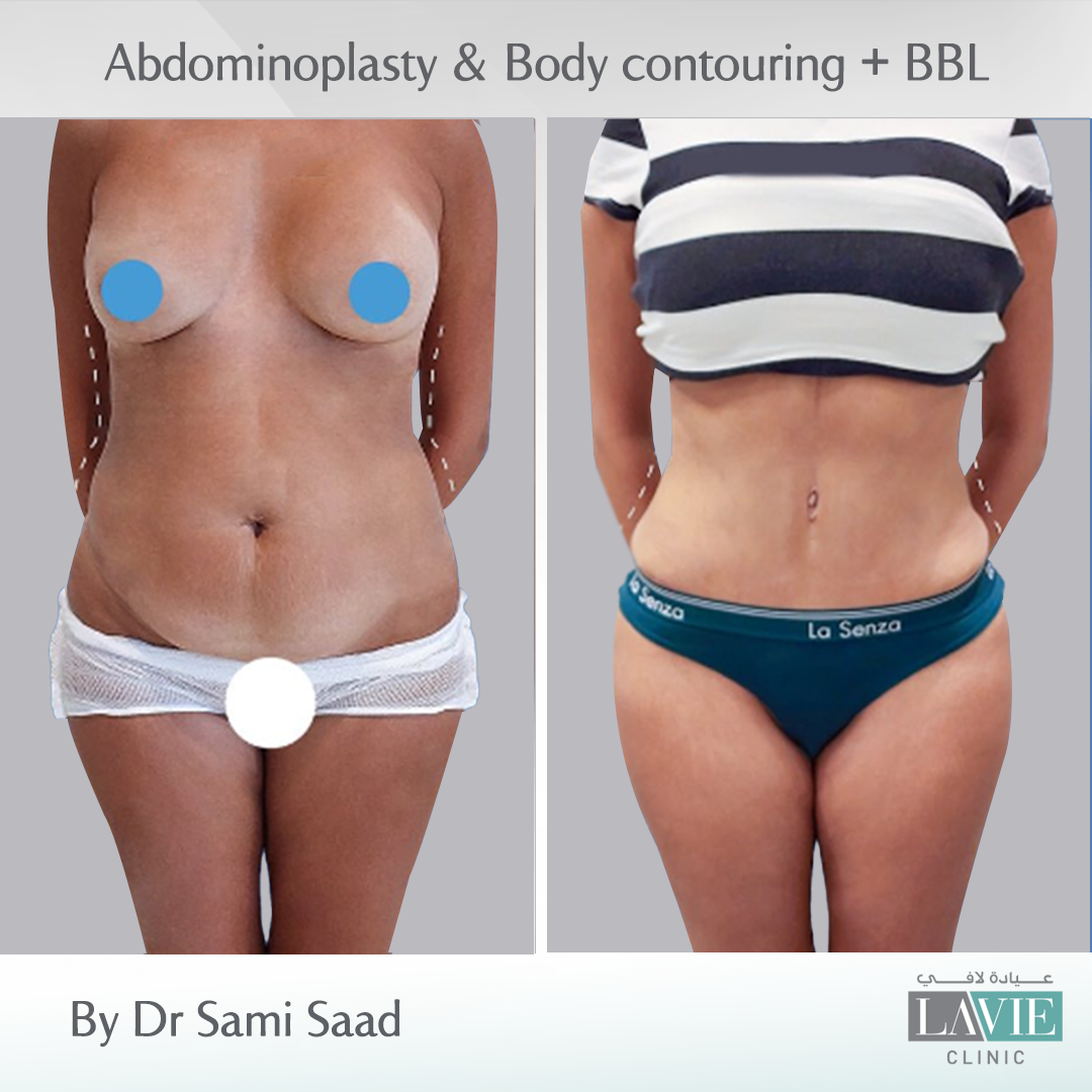 dr-sami-saad-cases-4