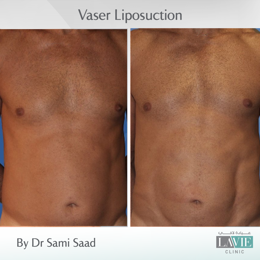 dr-sami-saad-cases-5
