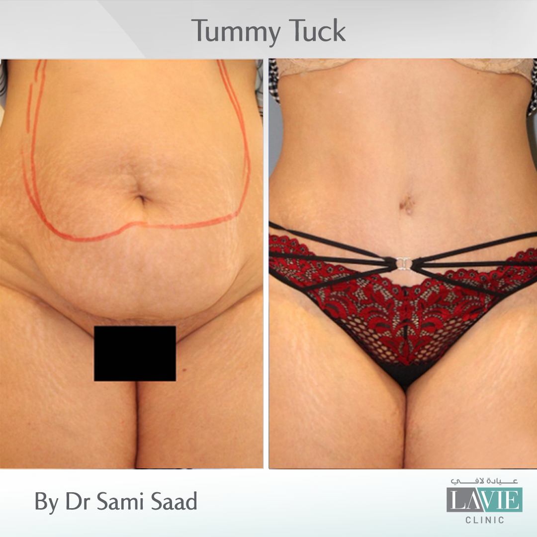 dr-sami-saad-cases-6
