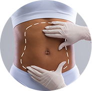 tummy-tuck
