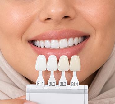 veneers_img